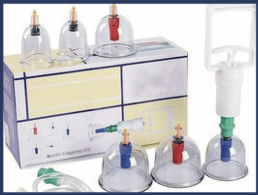 Vacuum Cupping Set of Six — Scanda Enterprises, medical supplies Moosapet Hyderabad